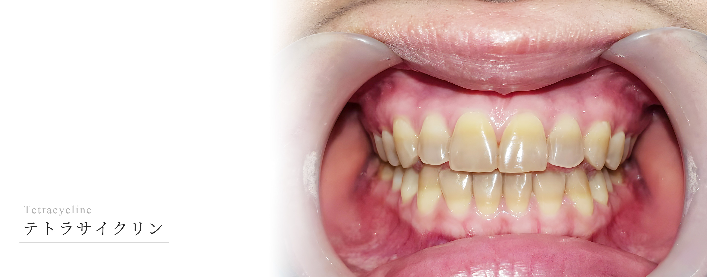 キービジュアル