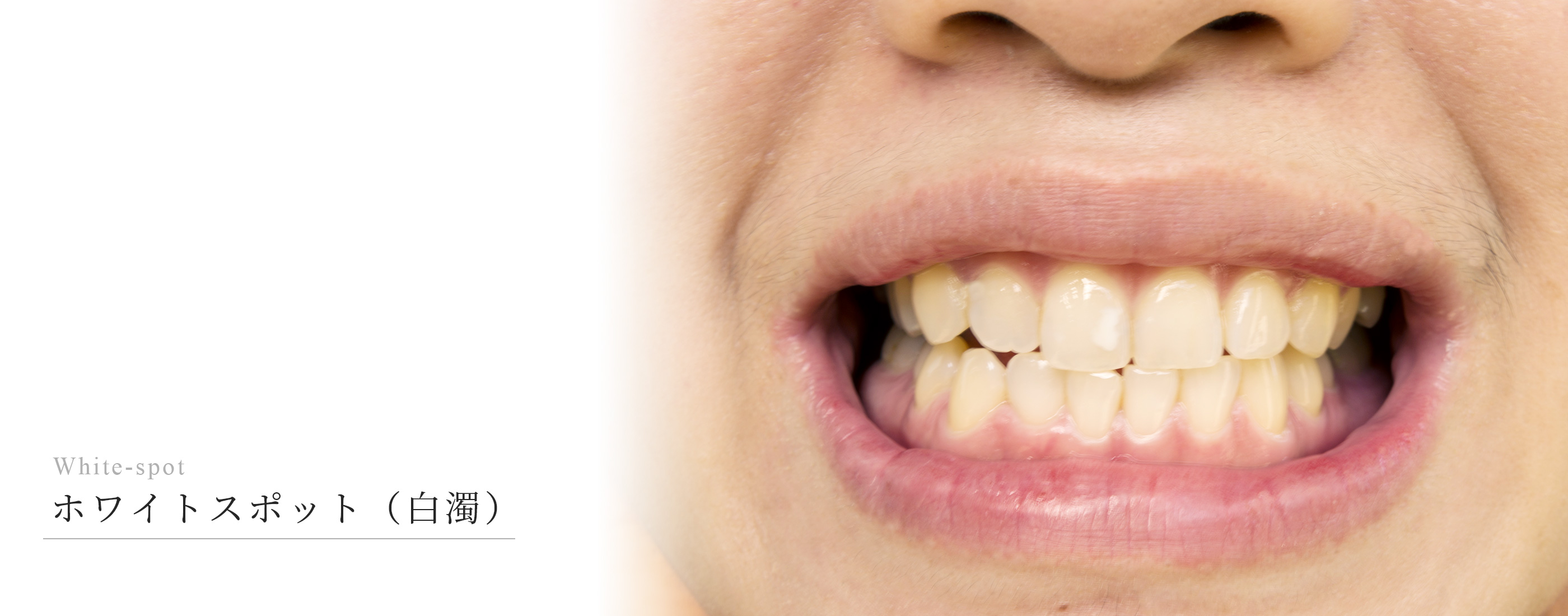 キービジュアル