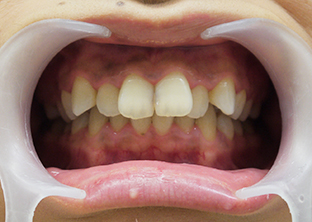 予約の準備方法