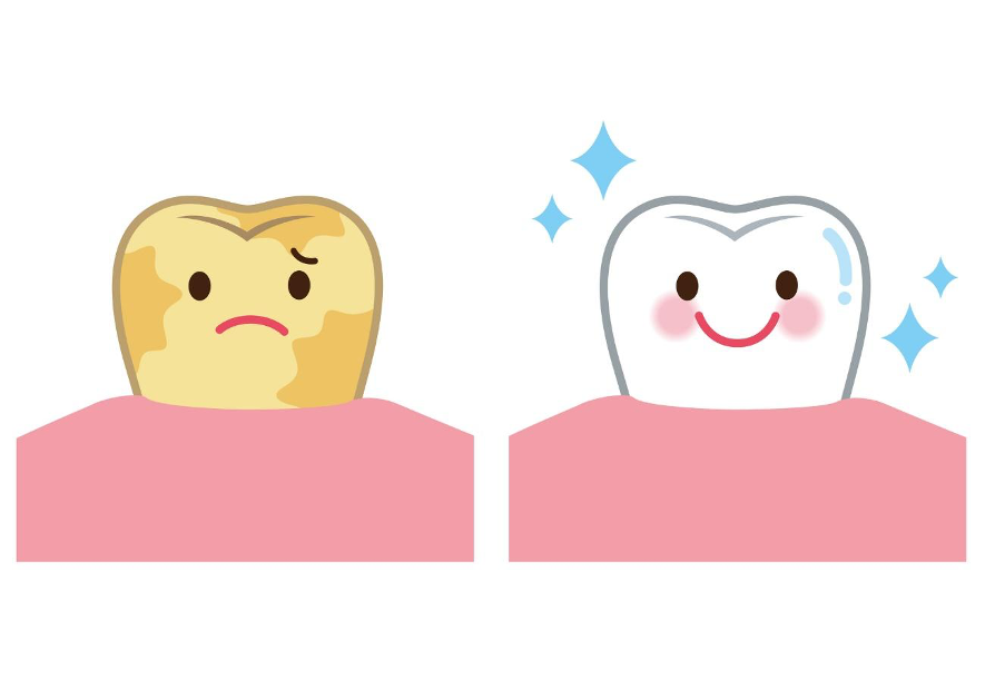 銀座の審美歯科医が解説！テトラサイクリン歯の悩み、削らずに白くする3つの選択肢