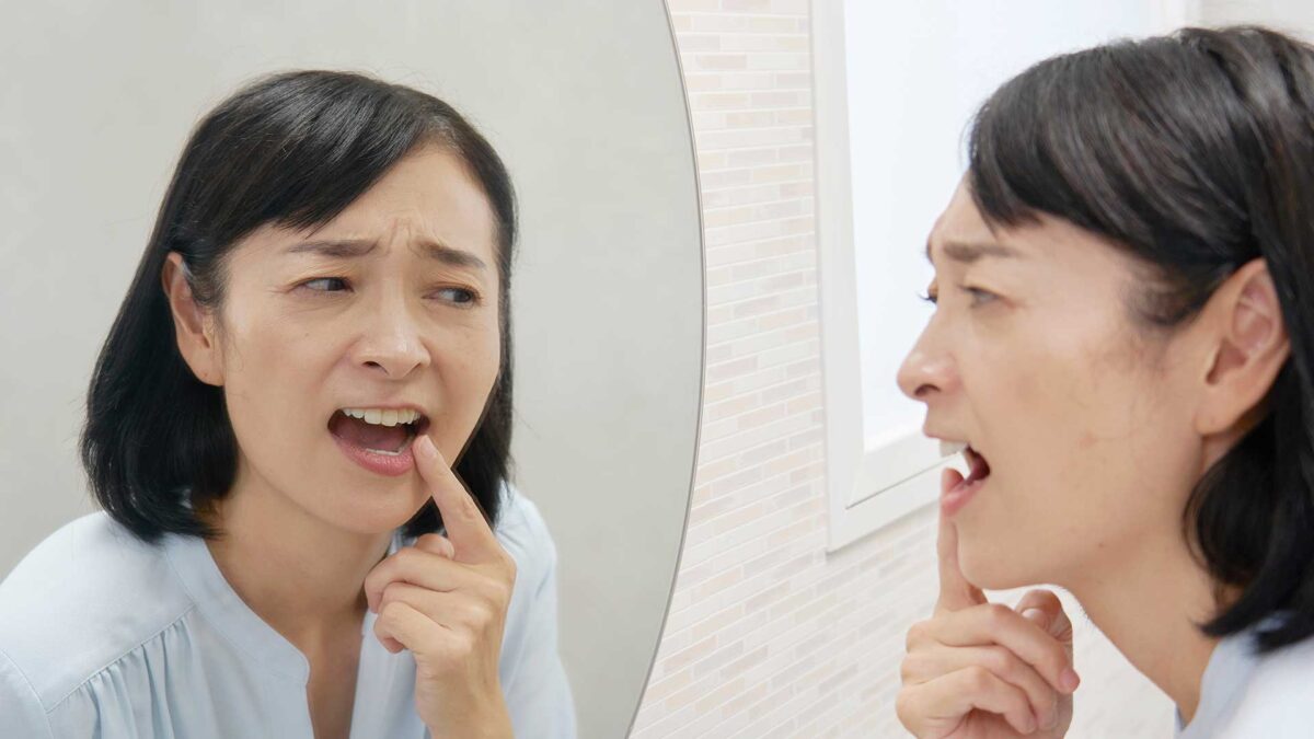 健康な歯を大きく削ってクラウン(差し歯)を被せる治療の解説