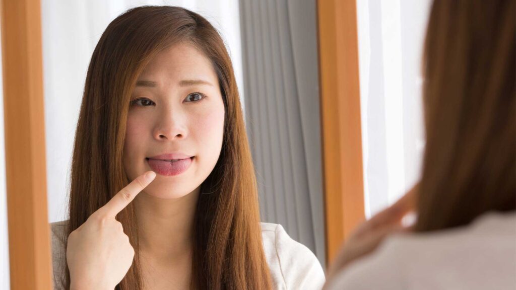 東京銀座の審美歯科が解説する老け顔の原因となる「下がり舌（舌癖）」の簡単なセルフチェック方法
