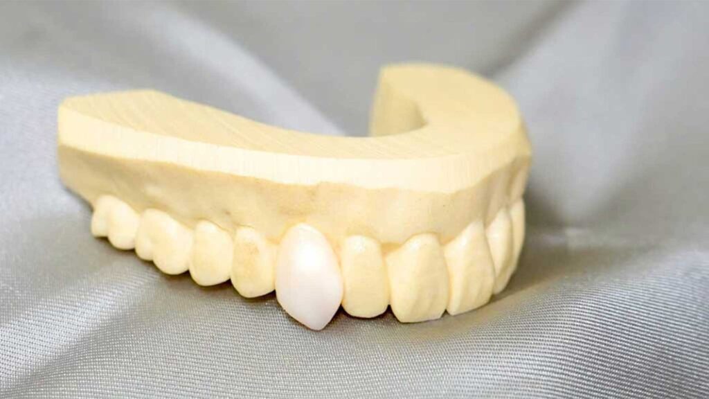 東京銀座の審美歯科が解説する歯並びの乱れが招く審美と健康への4大リスク