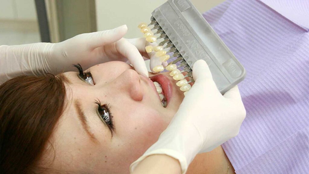 歯の模型やカラーサンプルを前に、歯科医師と笑顔のデザインを相談する様子