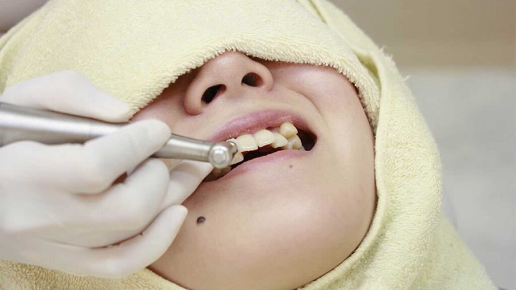 銀座の審美歯科が目的別に比較解説する大人の歯並び治療4つの主な選択肢