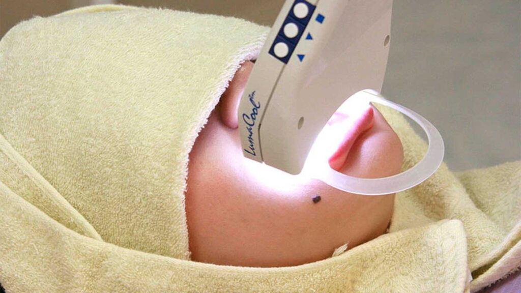 銀座の審美歯科が教える歯の黒い点の消し方。東京で受けるプロのケア。